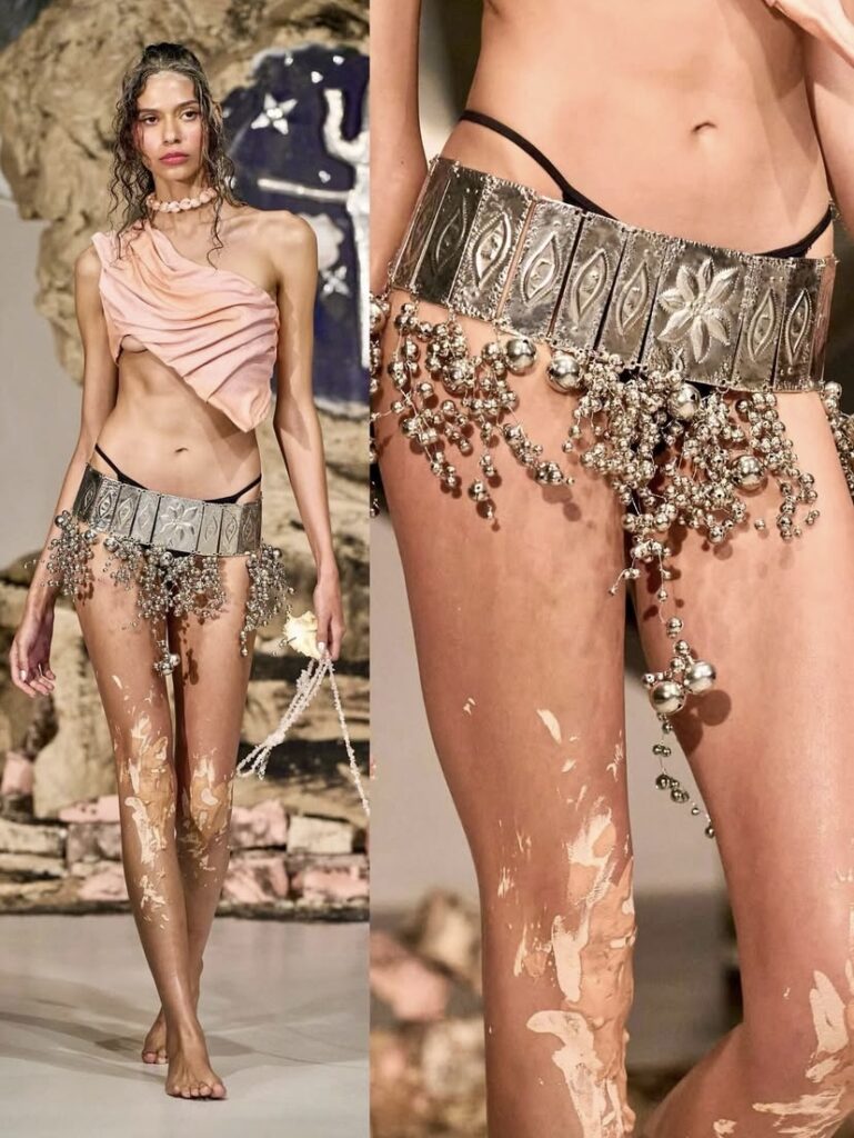 Alopecia Aphrodite - Look 3